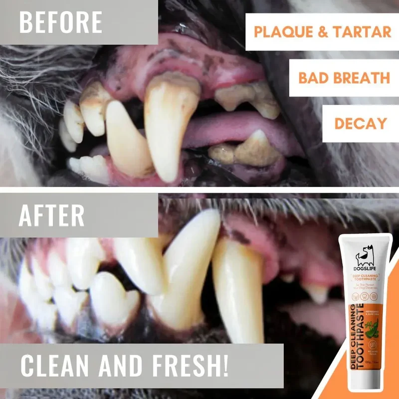 Dental Care Set